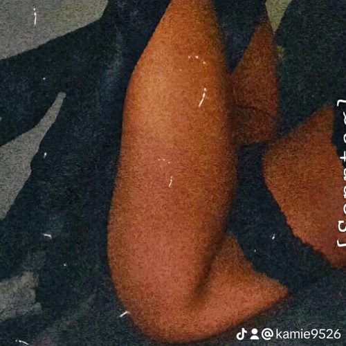 1000124487